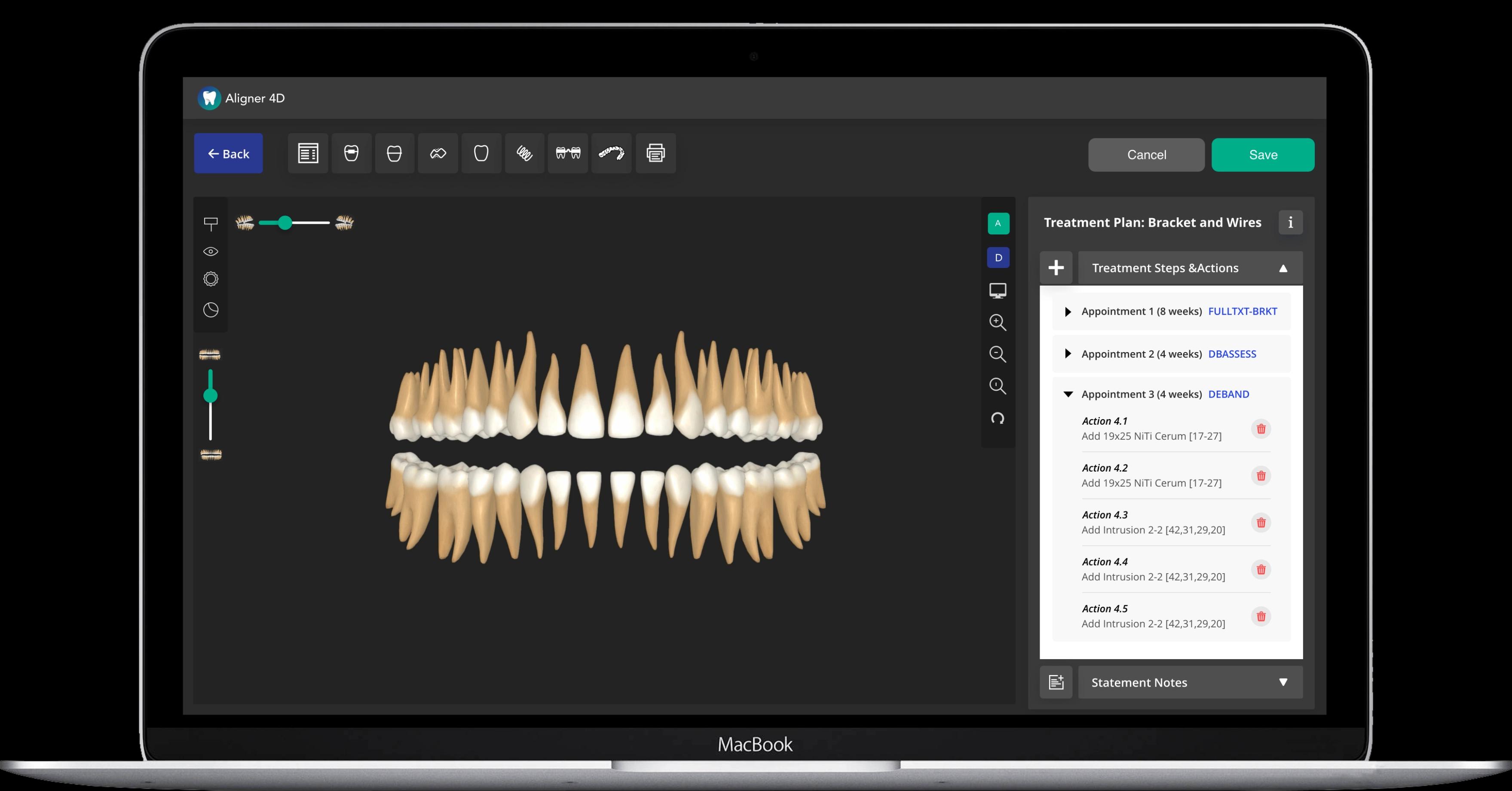 aligner-feature-mockup-2