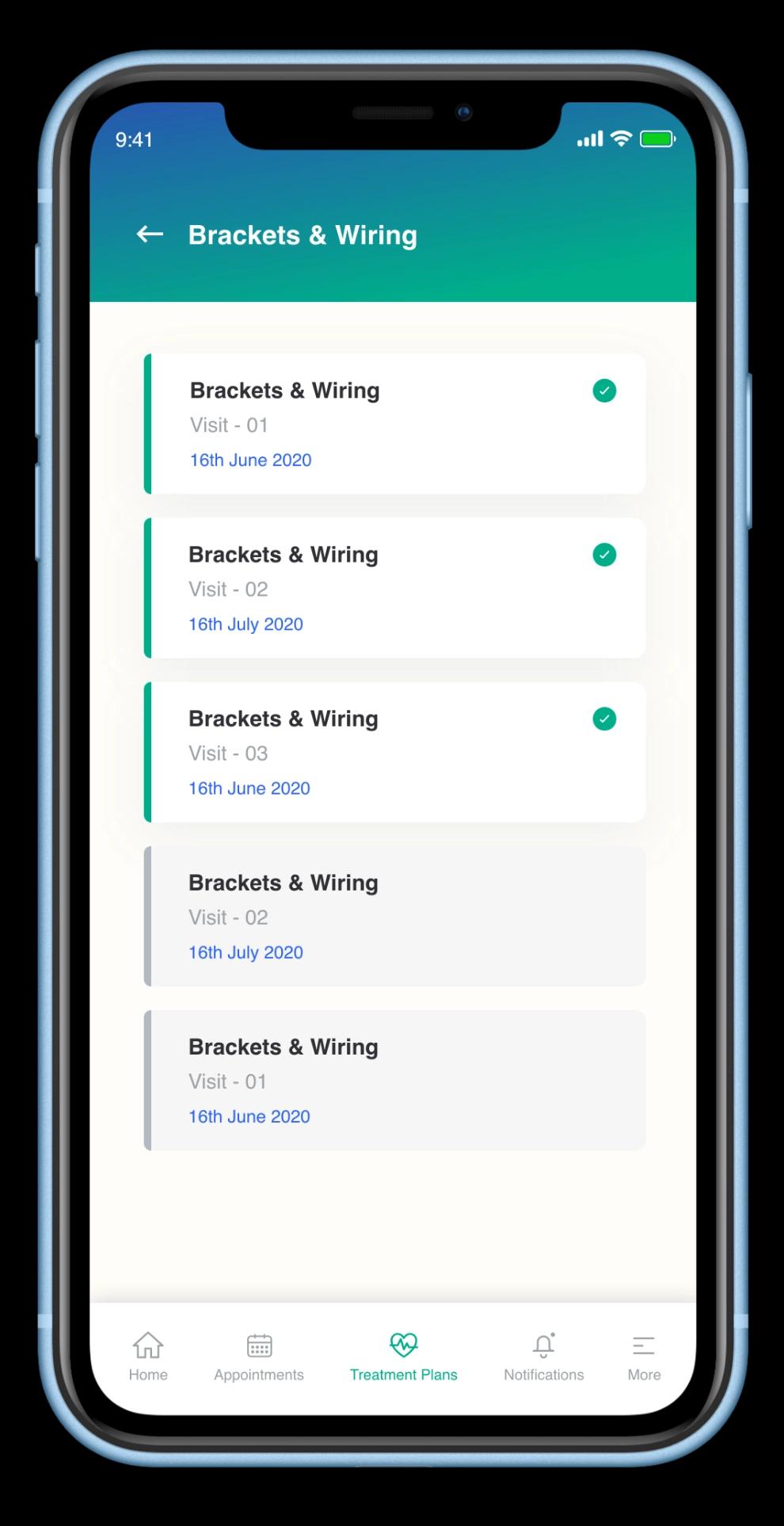 aligner-making-mockup