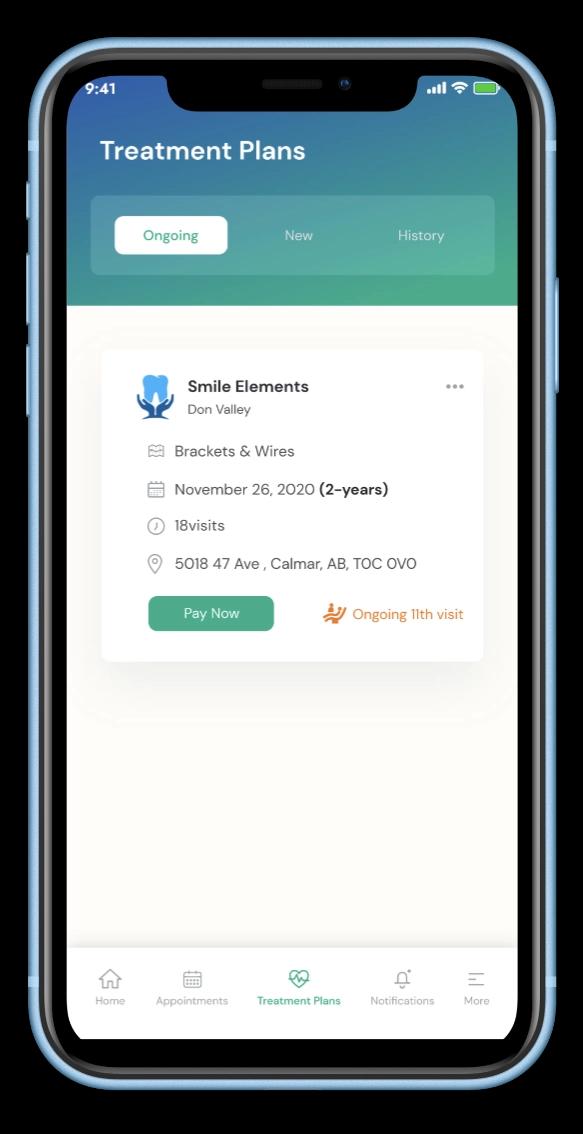 aligner-mobile-mockup-2