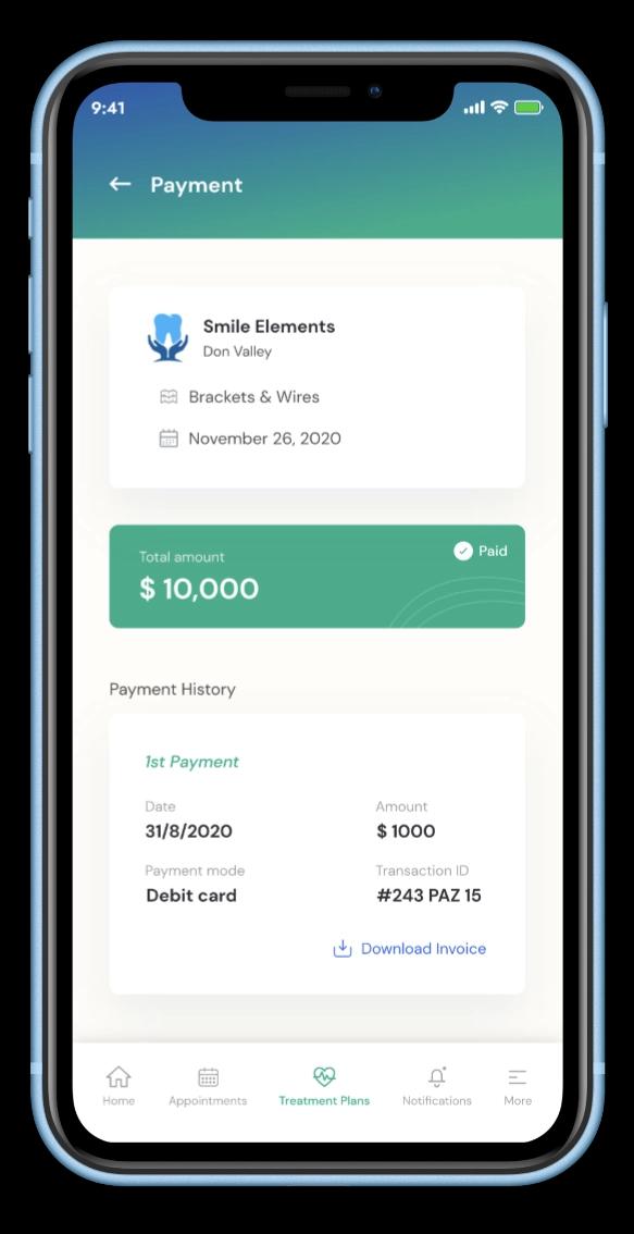 aligner-mobile-mockup-4