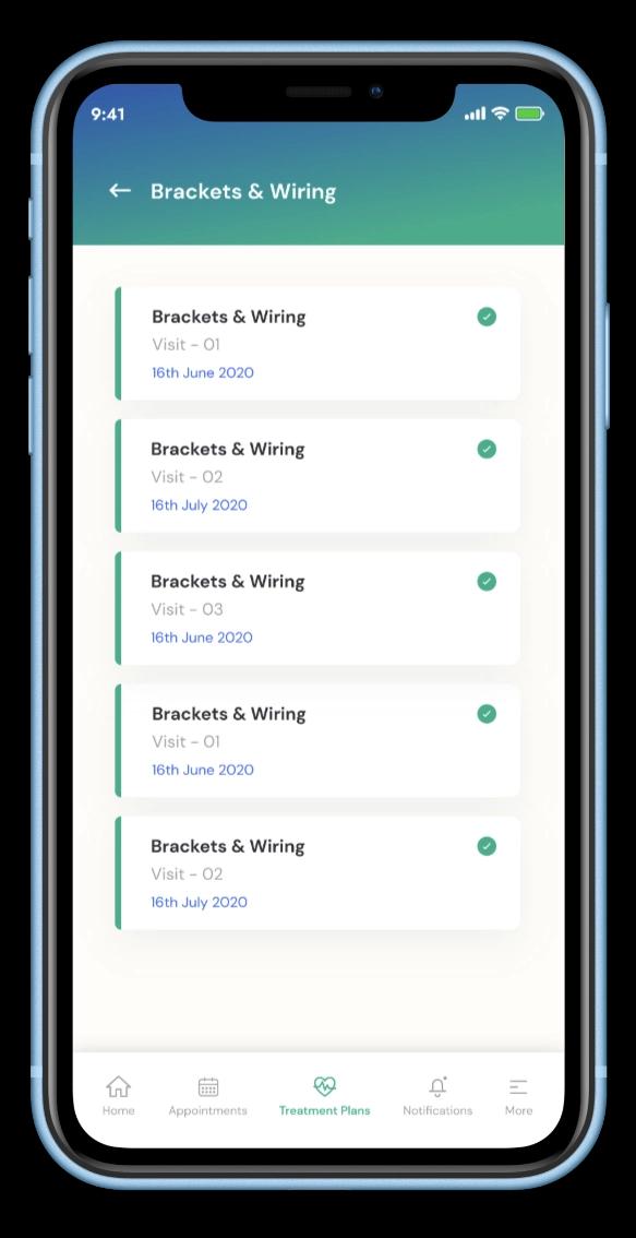 aligner-mobile-mockup-5